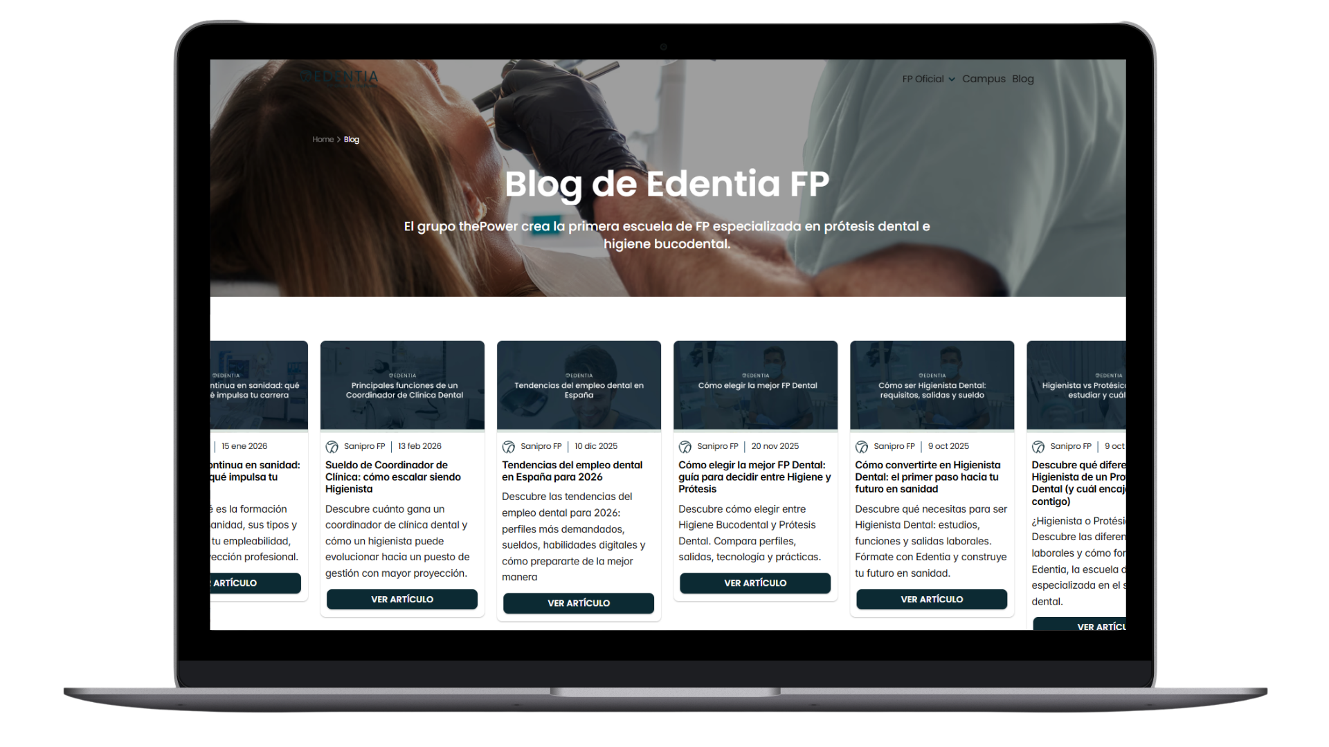 Blog sobre tecnología dental